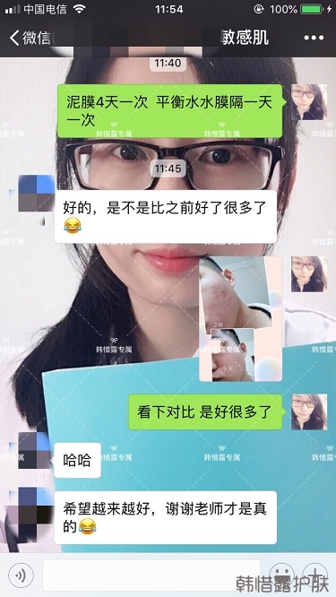 粉刺、痘痘、痘印、統(tǒng)統(tǒng)解決啦！祛痘去粉刺就是這么簡單！