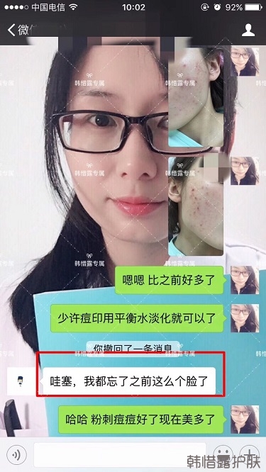 痘痘好了皮膚美麗，不想再記起曾經滿臉痘痘的自己！