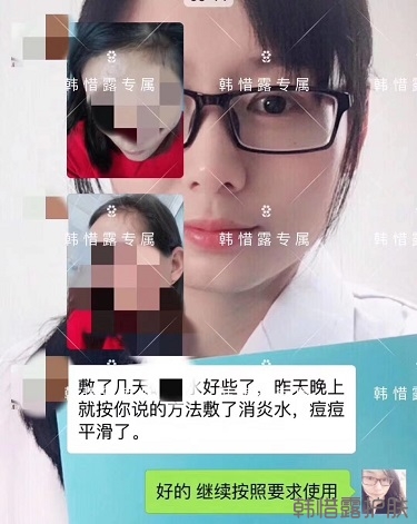 什么產品祛痘效果好？有什么祛痘效果好的產品？