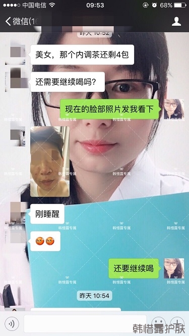 膿包結(jié)節(jié)發(fā)硬痘痘全消了，帥哥開心的來反饋了！