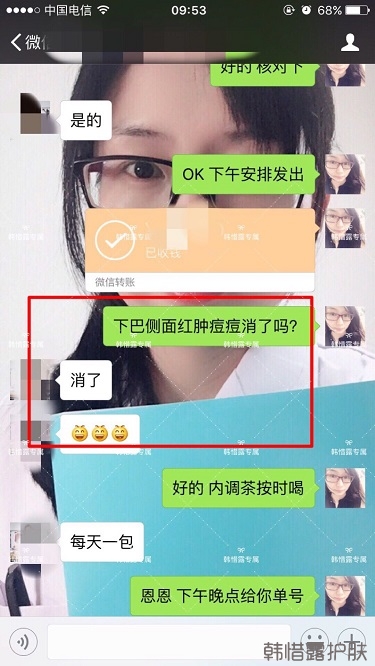 膿包結(jié)節(jié)發(fā)硬痘痘全消了，帥哥開心的來反饋了！