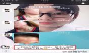 下巴長痘怎么辦？看這里徹底去掉痘痘，不再長痘了！